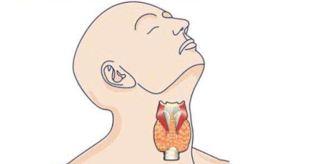 苏州哪有治疗甲状腺好的医生？(图1)